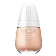 Clinique - Clinique Even Better Clinical Serum Fondöten SPF 20 CN 02 Breeze 30 ml